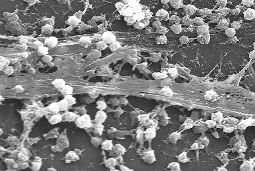 Staphylococccus aureus biofilm